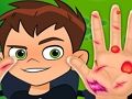 Permainan Doktor Tangan Ben10  talian