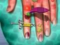 Permainan Doktor Kulit Tangan talian