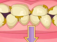 Permainan Bad Teeth Makeover talian
