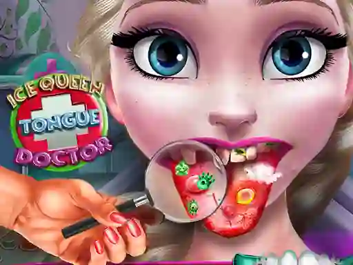 Permainan Ice Queen Tongue Doctor talian