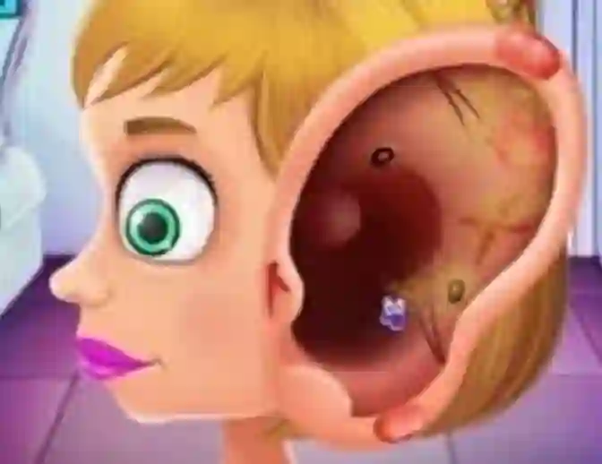 Permainan Children's Doctor Treating Ears talian