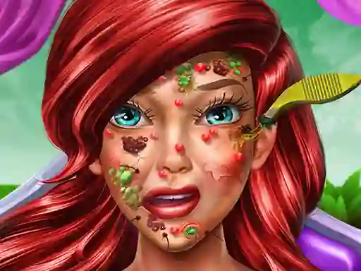 Permainan Princess Mermaid Skin Doctor talian