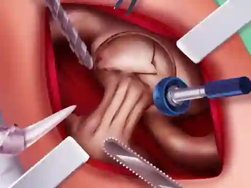 Permainan Princess Hips Surgery talian