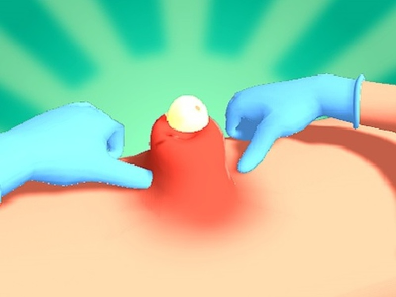 Permainan Pimple Squeeze talian