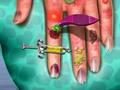 Permainan Doktor Kulit Tangan talian